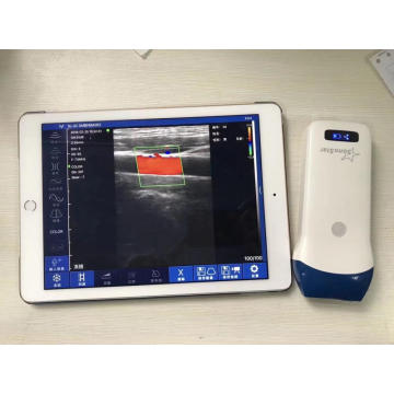 handheld wireless ultrasound for phone and pad